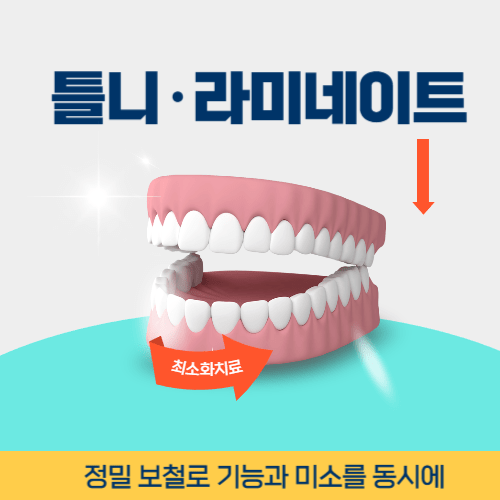 의왕치과 의왕시 치과 틀니 라미네이트