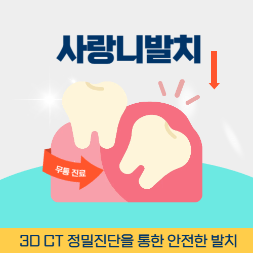 의왕치과 의왕시 치과 사랑니 발치