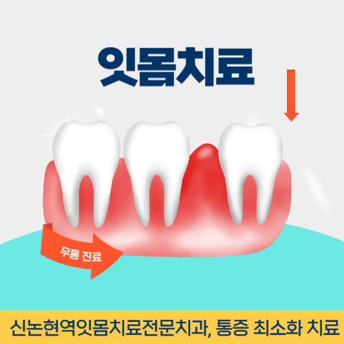 의왕치과 의왕시 치과 잇몸치료
